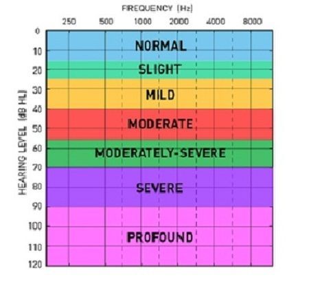 Audiogram Curetechie causes of hearing loss post